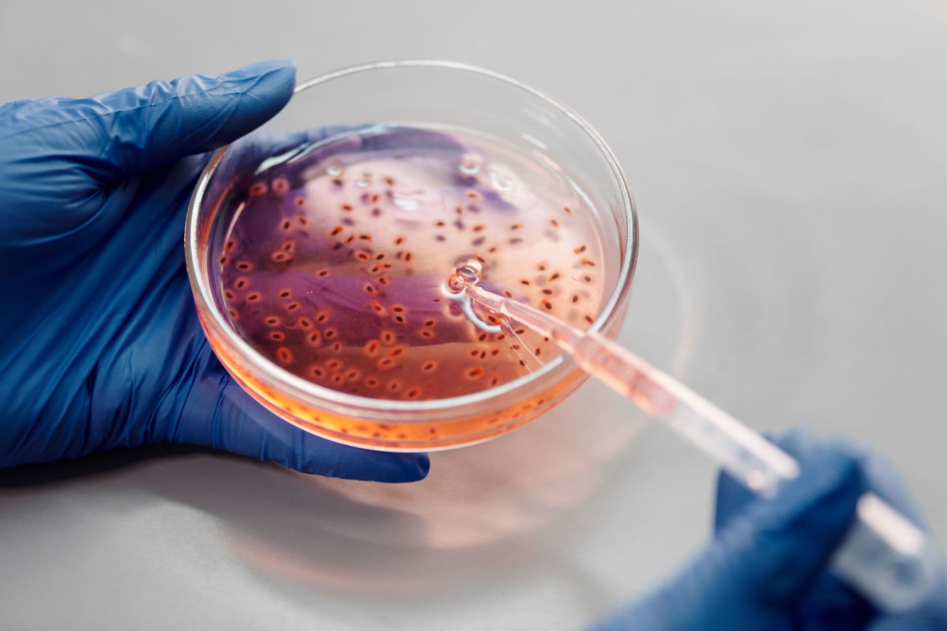 Your Junk DNA Is Finally Cleaning Its Room