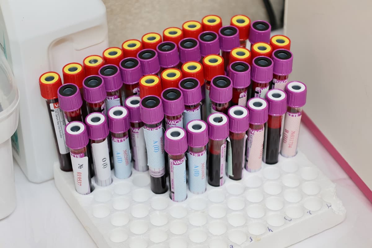 a sterile laboratory computer screen showing complex red protein structures