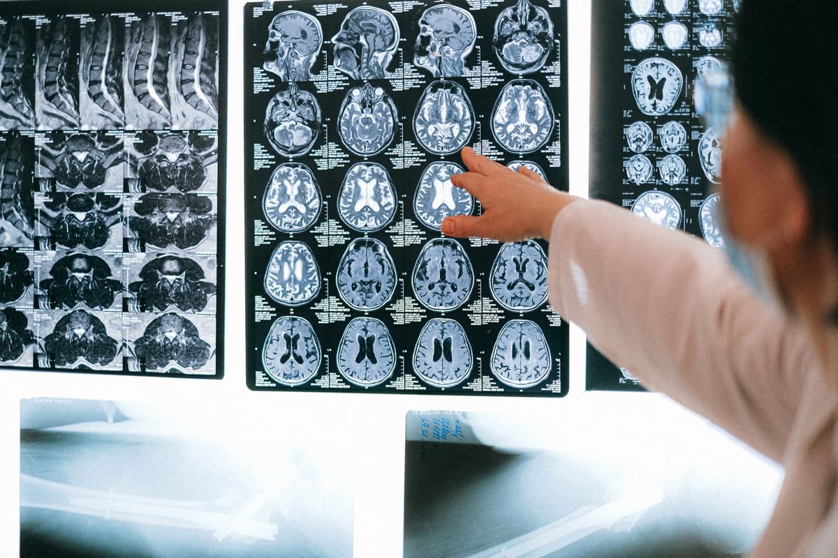 a high-resolution glowing 3D brain scan model