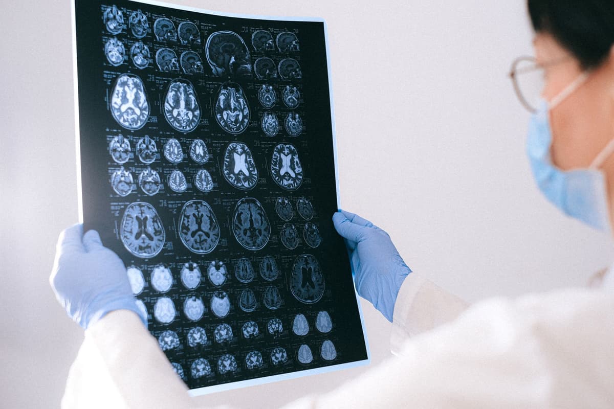 a high-resolution brain scan on a dark monitor